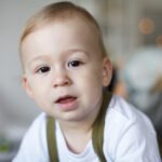 Dudak ve Damak Yarıklığı